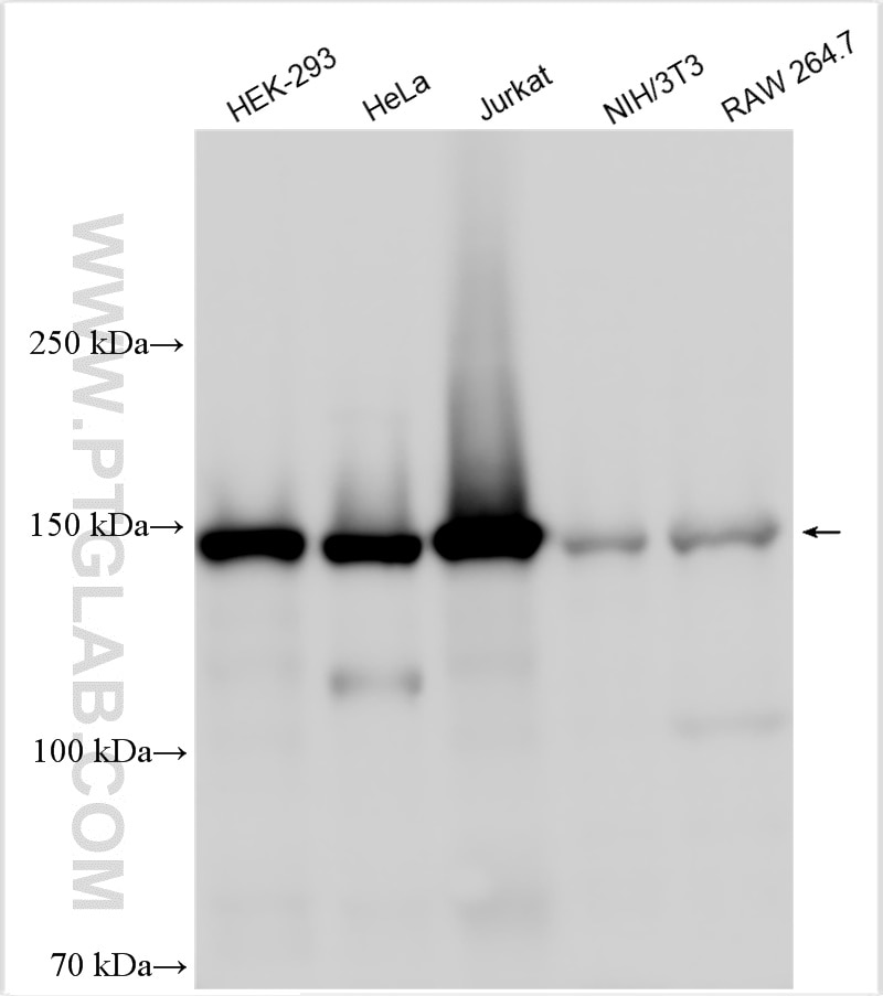 Western Blot (WB) analysis of various lysates using TIMELESS Polyclonal antibody (14421-1-AP)