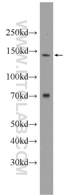 Western Blot (WB) analysis of NIH/3T3 cells using TIMELESS Polyclonal antibody (14421-1-AP)