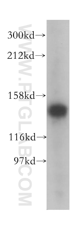 Western Blot (WB) analysis of A549 cells using TIMELESS Polyclonal antibody (14421-1-AP)