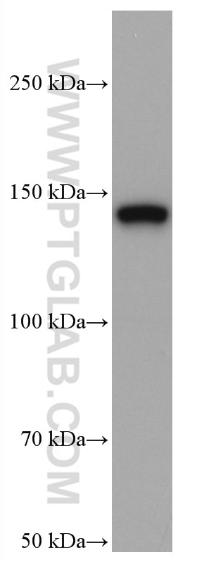 Western Blot (WB) analysis of A549 cells using TIMELESS Monoclonal antibody (67022-1-Ig)
