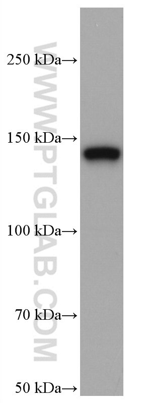 Western Blot (WB) analysis of A549 cells using TIMELESS Monoclonal antibody (67022-1-Ig)