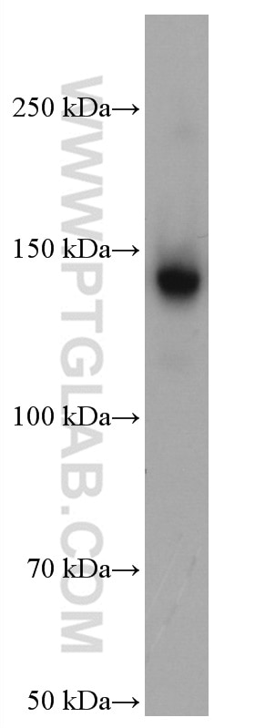 Western Blot (WB) analysis of JAR cells using TIMELESS Monoclonal antibody (67022-1-Ig)
