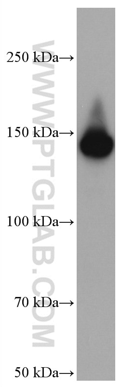 Western Blot (WB) analysis of Jurkat cells using TIMELESS Monoclonal antibody (67022-1-Ig)
