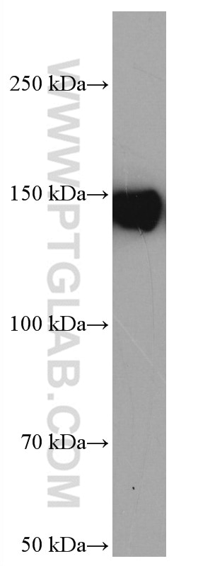 Western Blot (WB) analysis of HSC-T6 cells using TIMELESS Monoclonal antibody (67022-1-Ig)