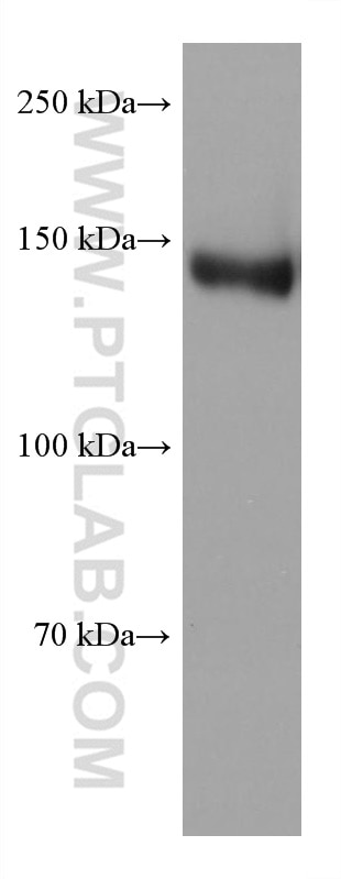 Western Blot (WB) analysis of U2OS cells using TIMELESS Monoclonal antibody (67022-1-Ig)