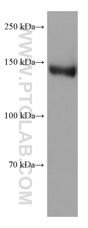 Western Blot (WB) analysis of U2OS cells using TIMELESS Monoclonal antibody (67022-1-Ig)