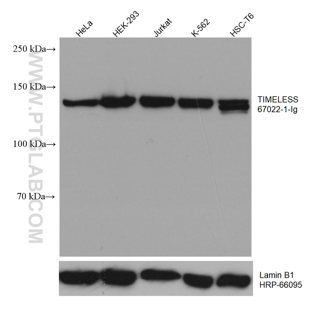 WB analysis using 67022-1-Ig