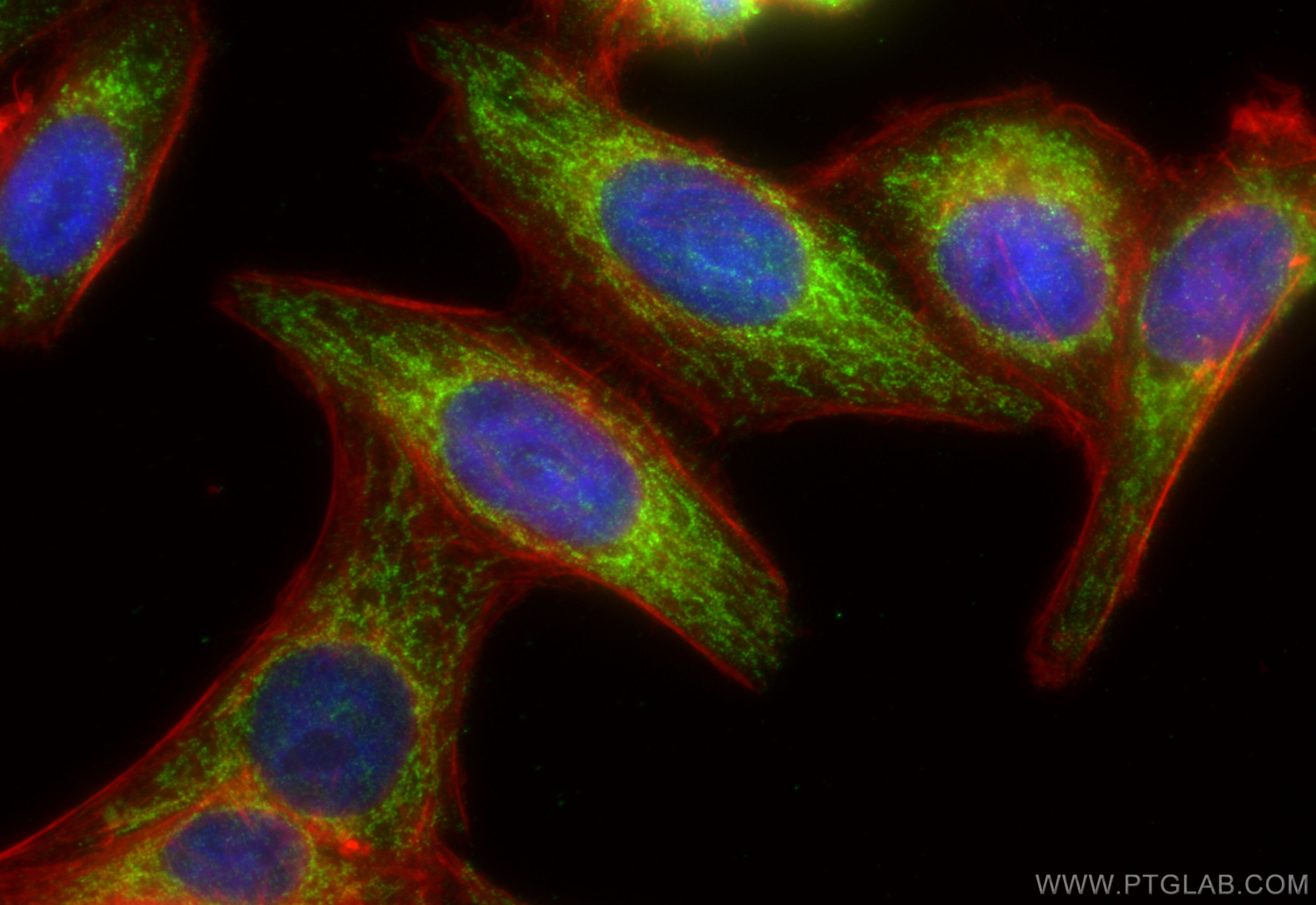 Immunofluorescence (IF) / fluorescent staining of HepG2 cells using TIM10 Polyclonal antibody (11124-2-AP)