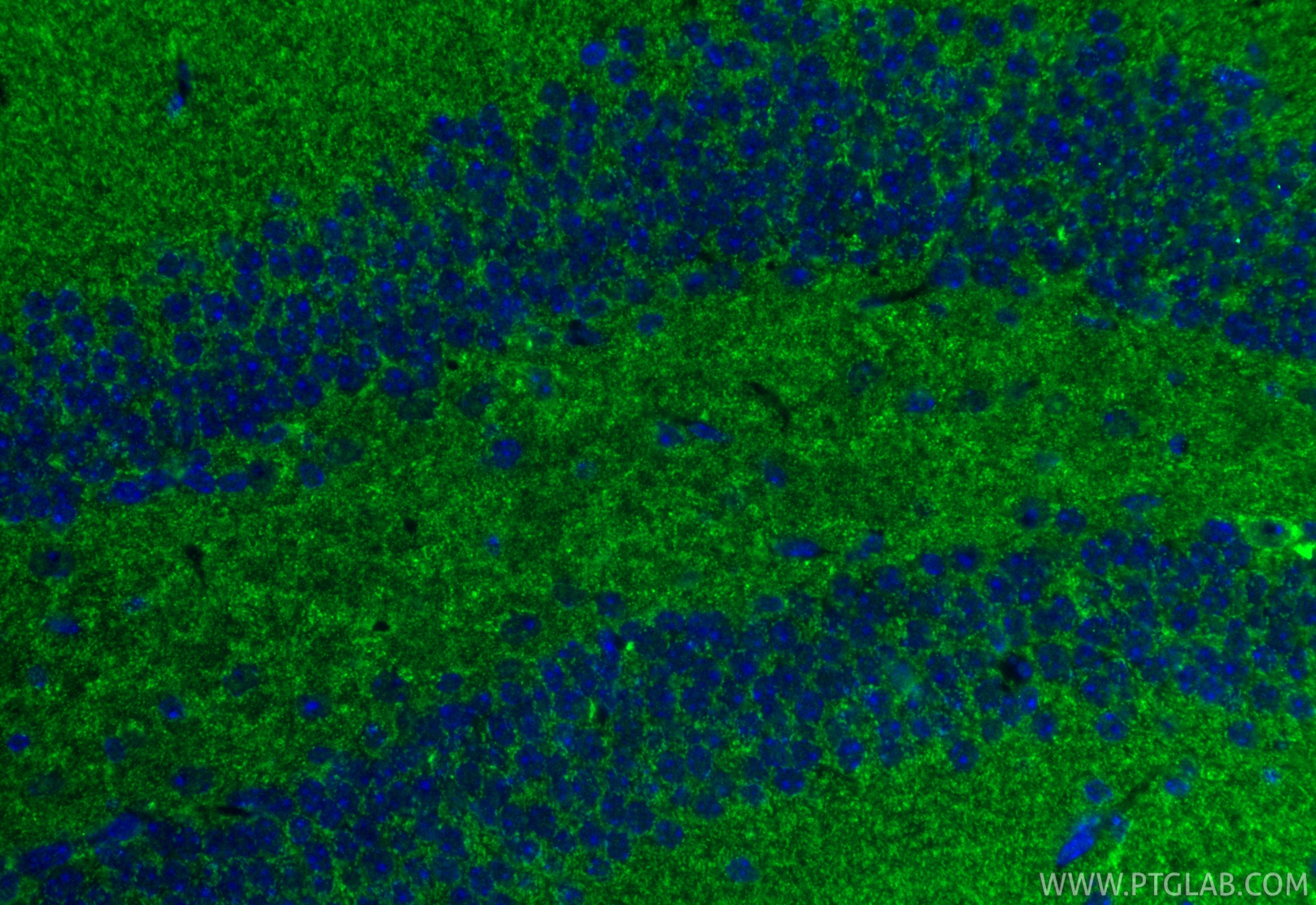 IF Staining of mouse brain using 11124-2-AP Immunofluorescence (IF) / fluorescent staining of mouse brain tissue using TIM10 Polyclonal antibody (11124-2-AP)