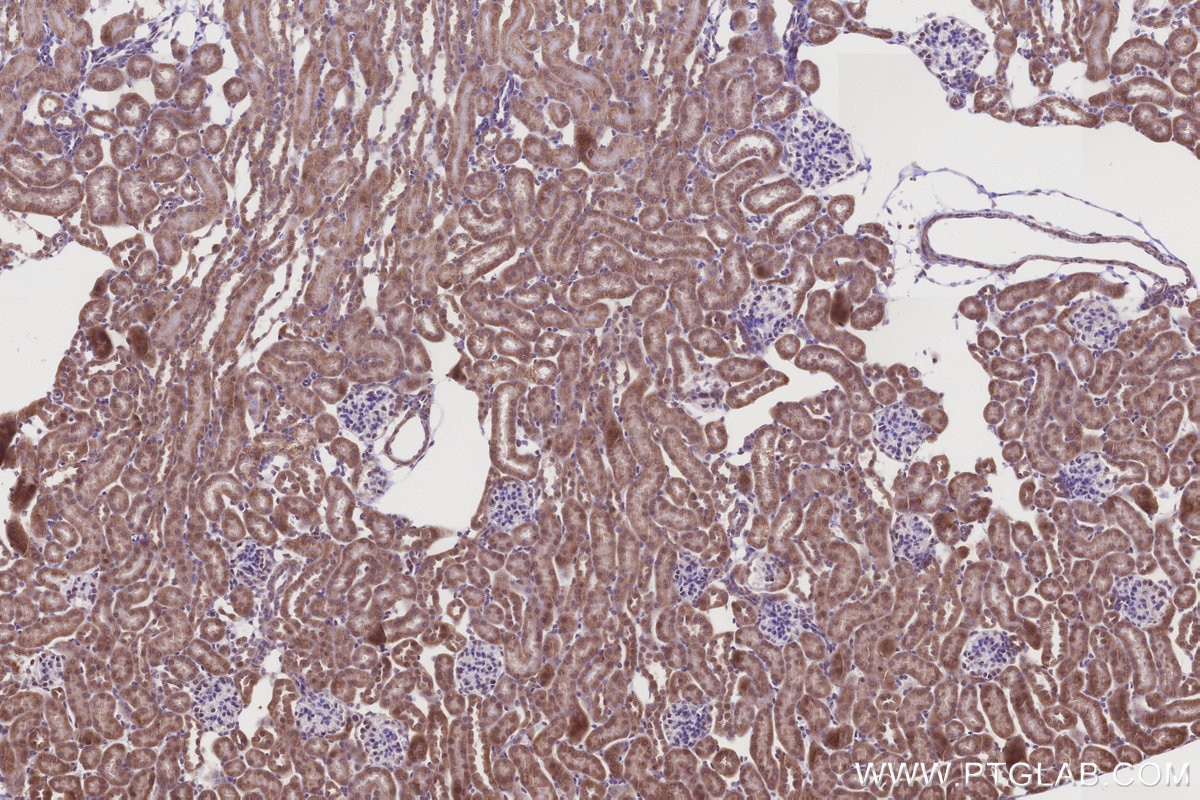 Immunohistochemistry (IHC) staining of mouse kidney tissue using TIM10 Polyclonal antibody (11124-2-AP)