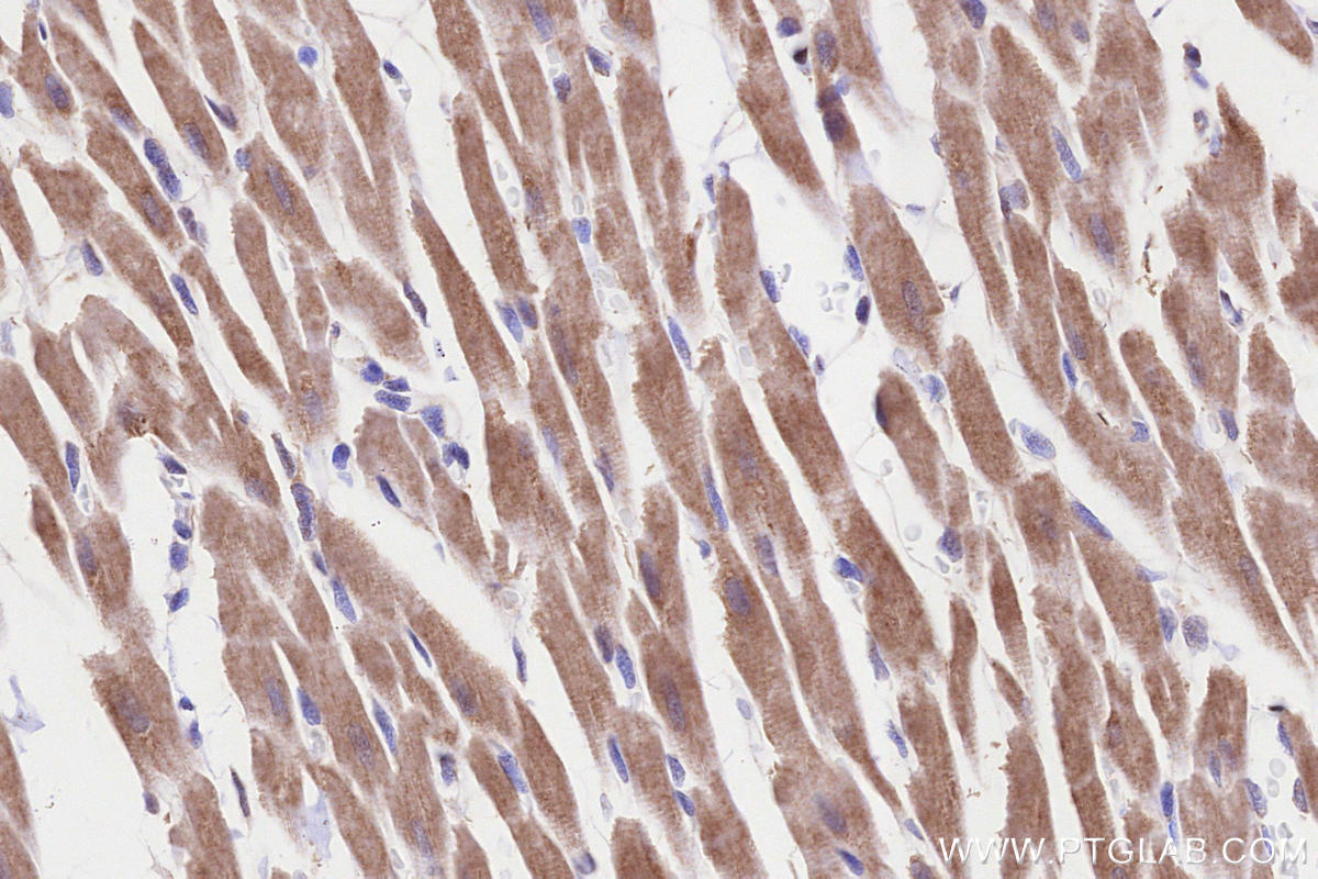 Immunohistochemistry (IHC) staining of rat heart tissue using TIM10 Polyclonal antibody (11124-2-AP)