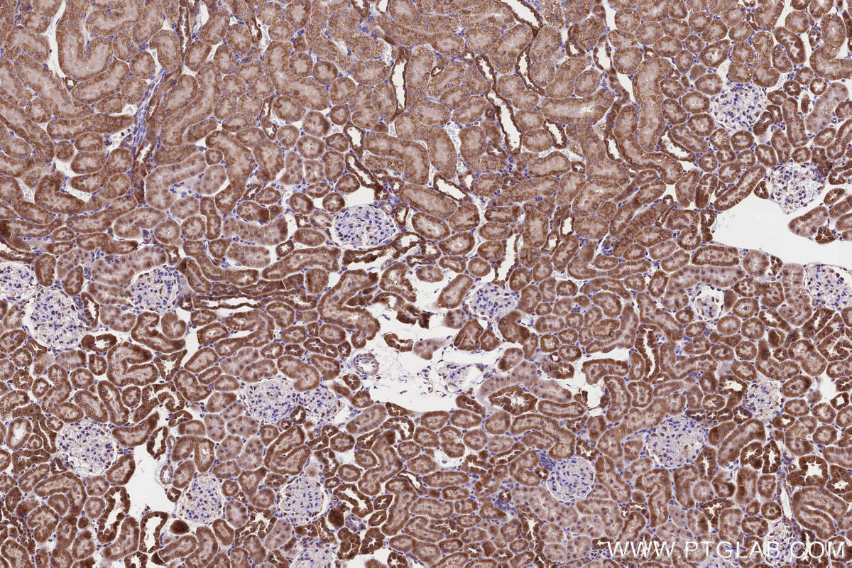 Immunohistochemistry (IHC) staining of rat kidney tissue using TIM10 Polyclonal antibody (11124-2-AP)