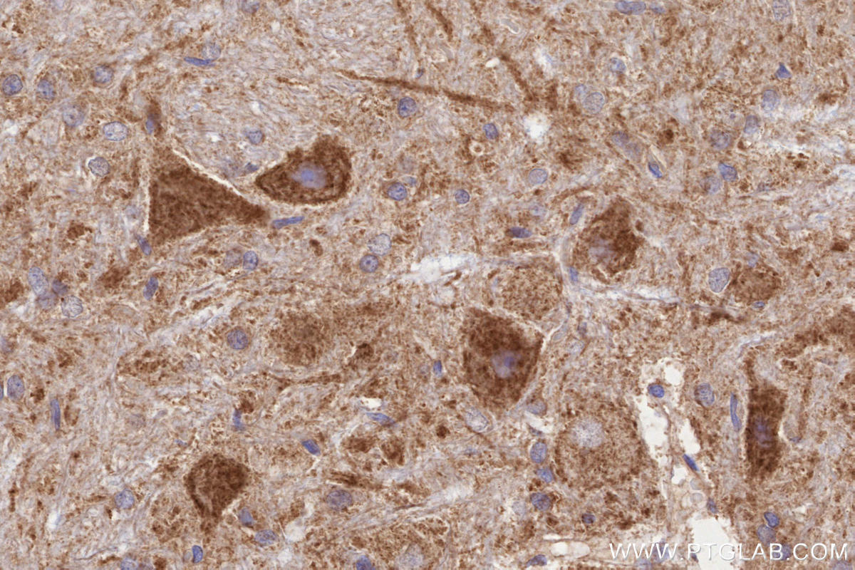 Immunohistochemistry (IHC) staining of rat cerebellum tissue using TIM10 Polyclonal antibody (11124-2-AP)