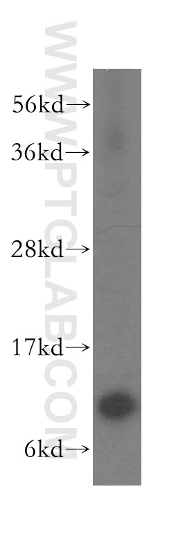 Western Blot (WB) analysis of human heart tissue using TIMM10 Polyclonal antibody (11124-2-AP)