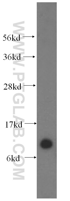 Western Blot (WB) analysis of human liver tissue using TIMM10 Polyclonal antibody (11124-2-AP)