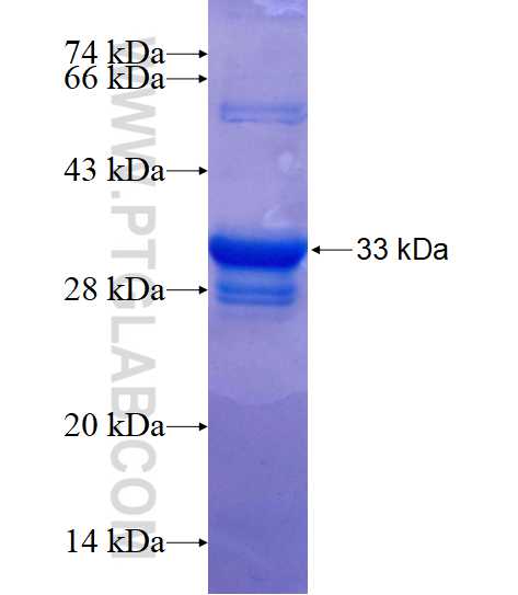 TIMM10 fusion protein Ag1615 SDS-PAGE