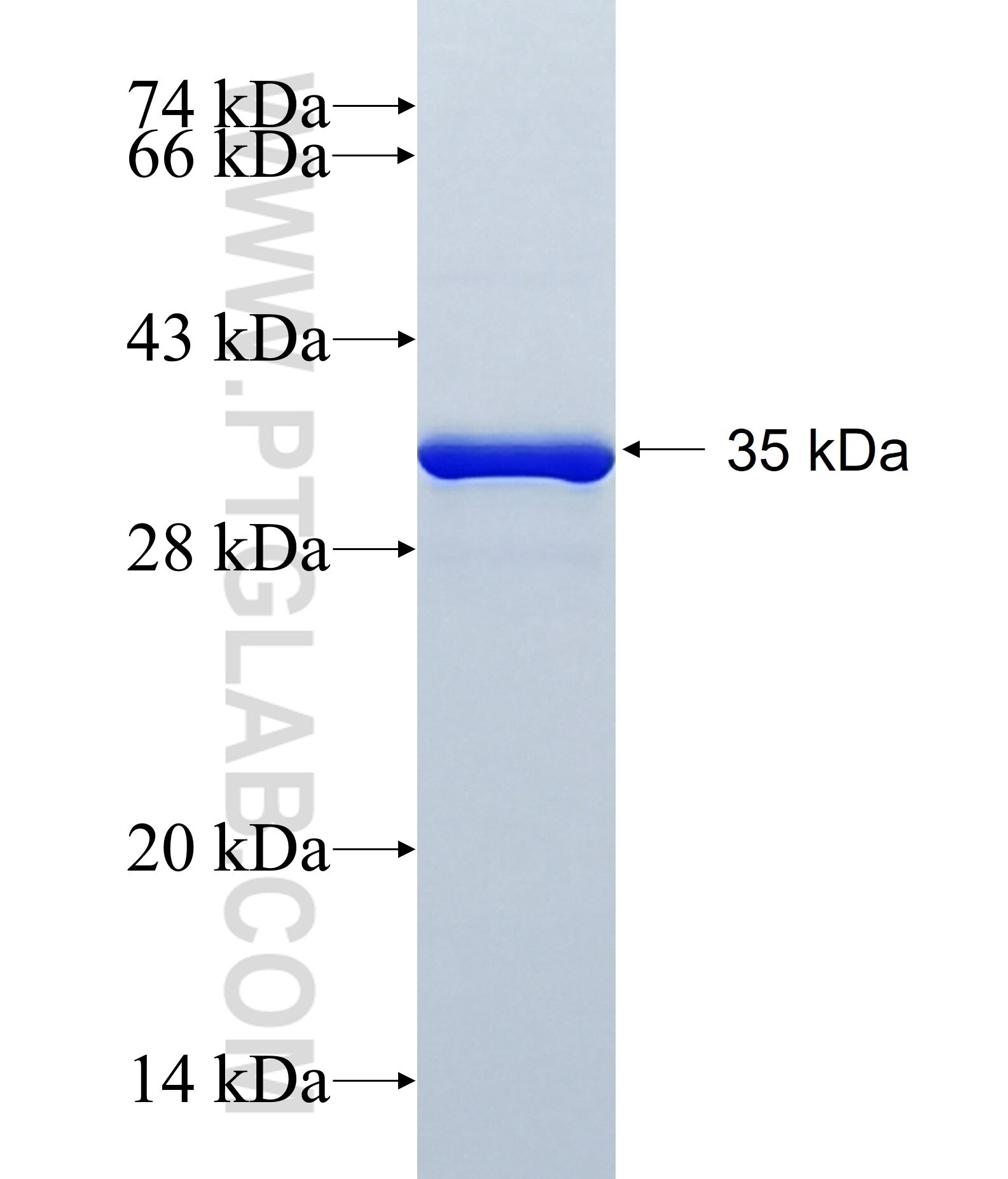 TIMM10 fusion protein Ag1615 SDS-PAGE