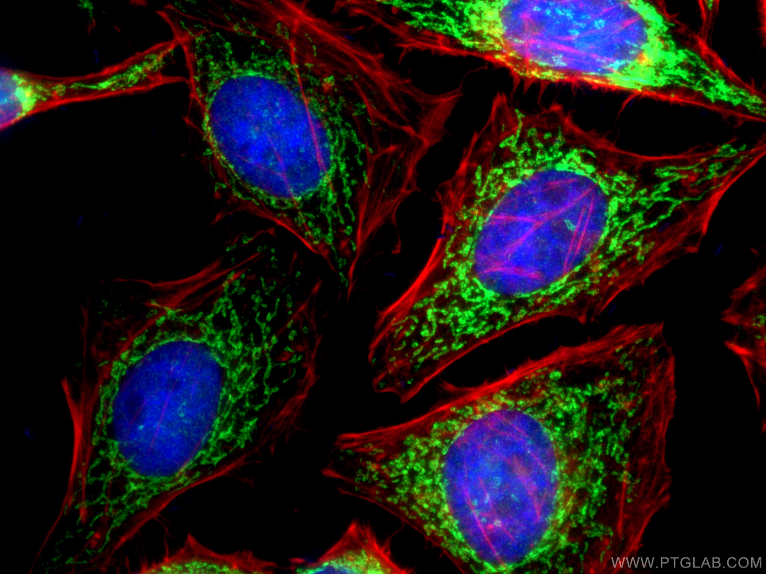 Immunofluorescence (IF) / fluorescent staining of HepG2 cells using TIMM13 Polyclonal antibody (11973-1-AP)