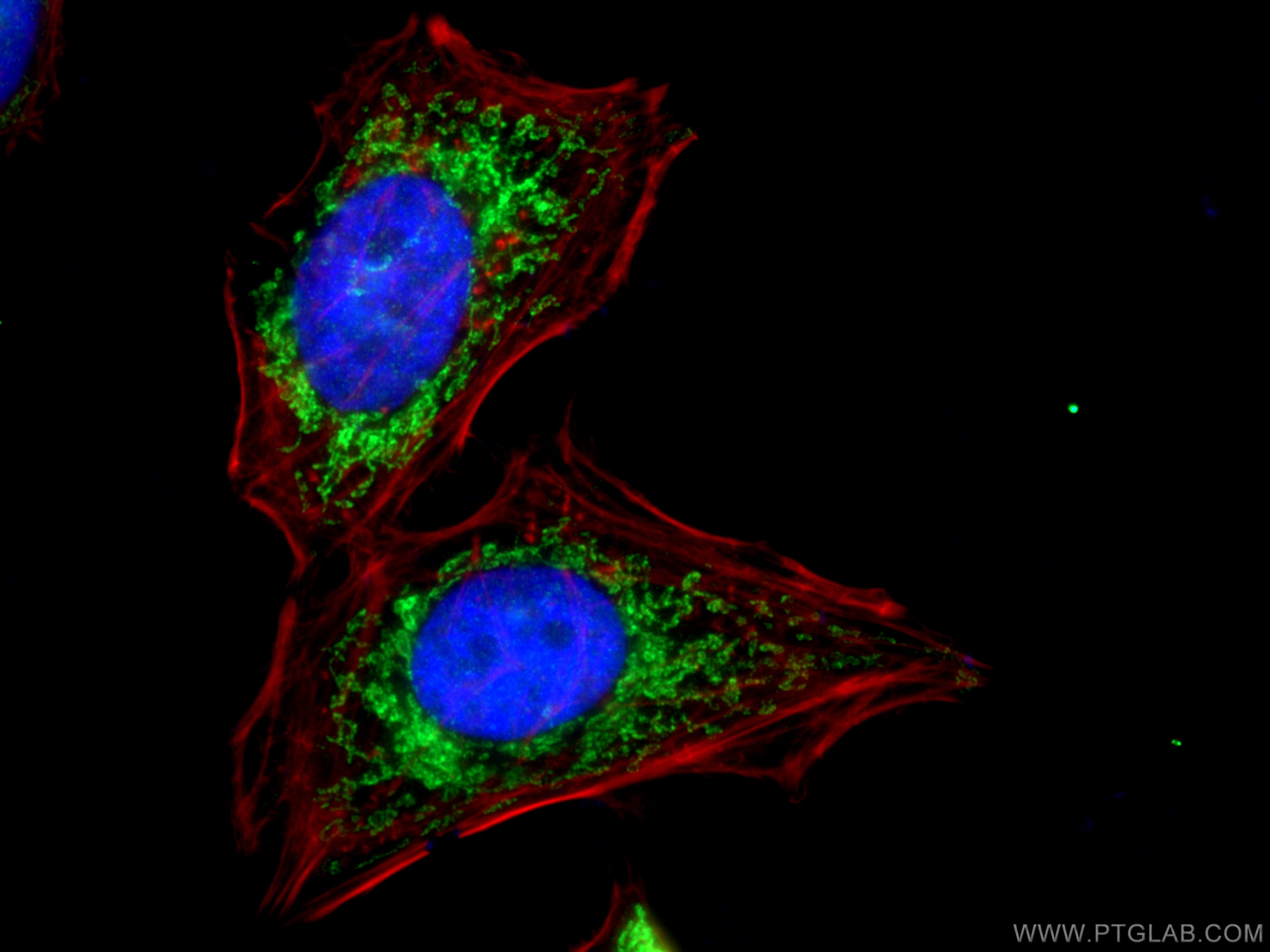 Immunofluorescence (IF) / fluorescent staining of HeLa cells using TIMM13 Polyclonal antibody (11973-1-AP)