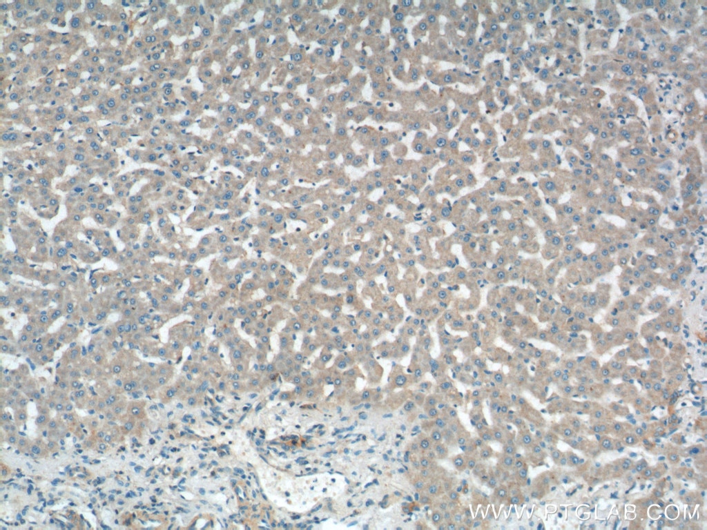 IHC staining of human liver using 11973-1-AP