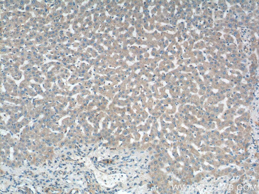 TIMM13 Polyclonal antibody