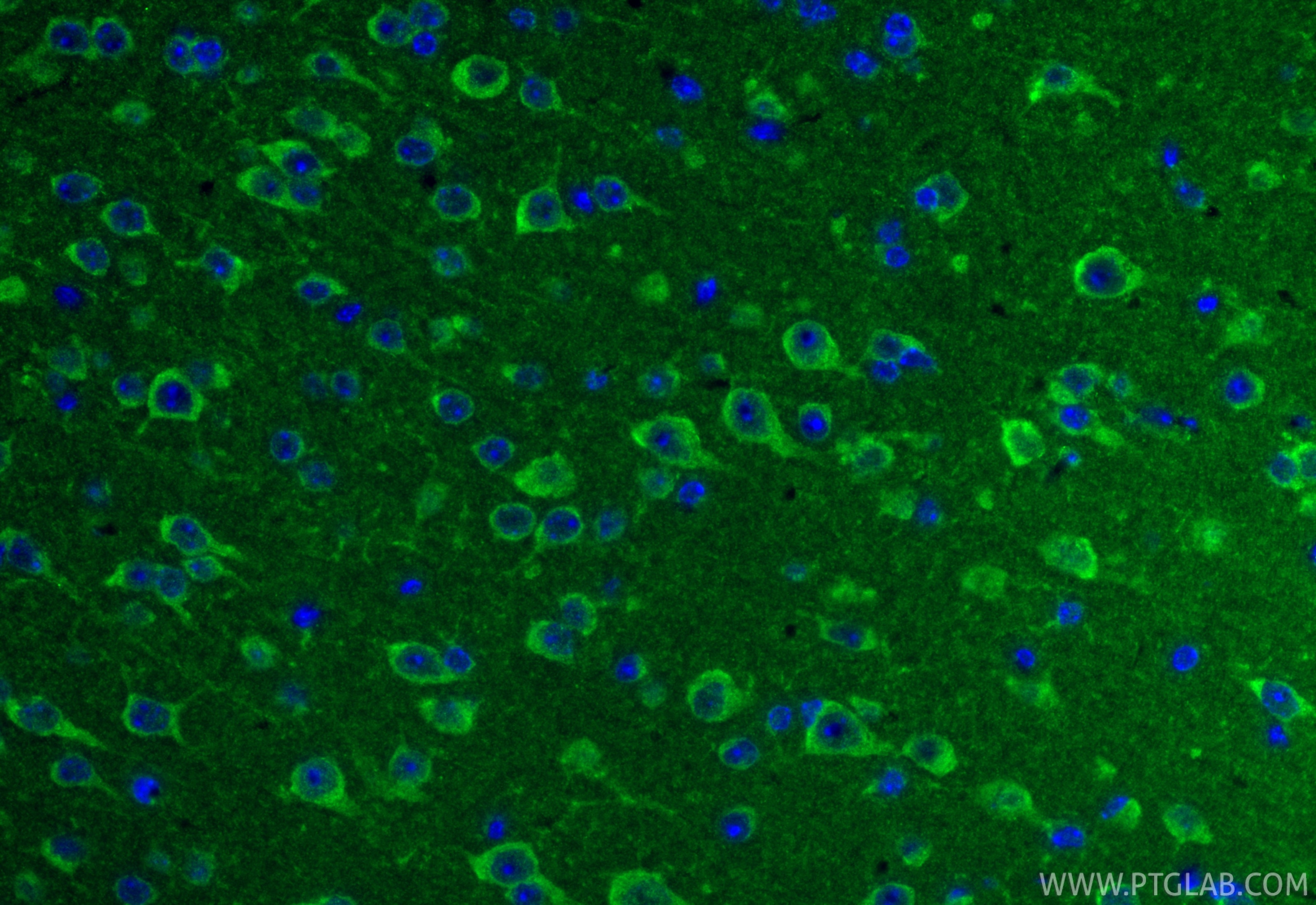 IF Staining of mouse brain using 11189-1-AP (same clone as 11189-1-PBS) Immunofluorescence (IF) / fluorescent staining of mouse brain tissue using TIMM17A Polyclonal antibody (11189-1-AP)
