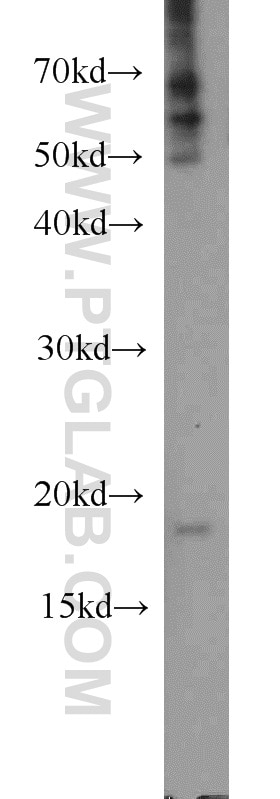 WB analysis of mouse liver using 11062-1-AP