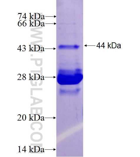 TIMM17B fusion protein Ag1504 SDS-PAGE