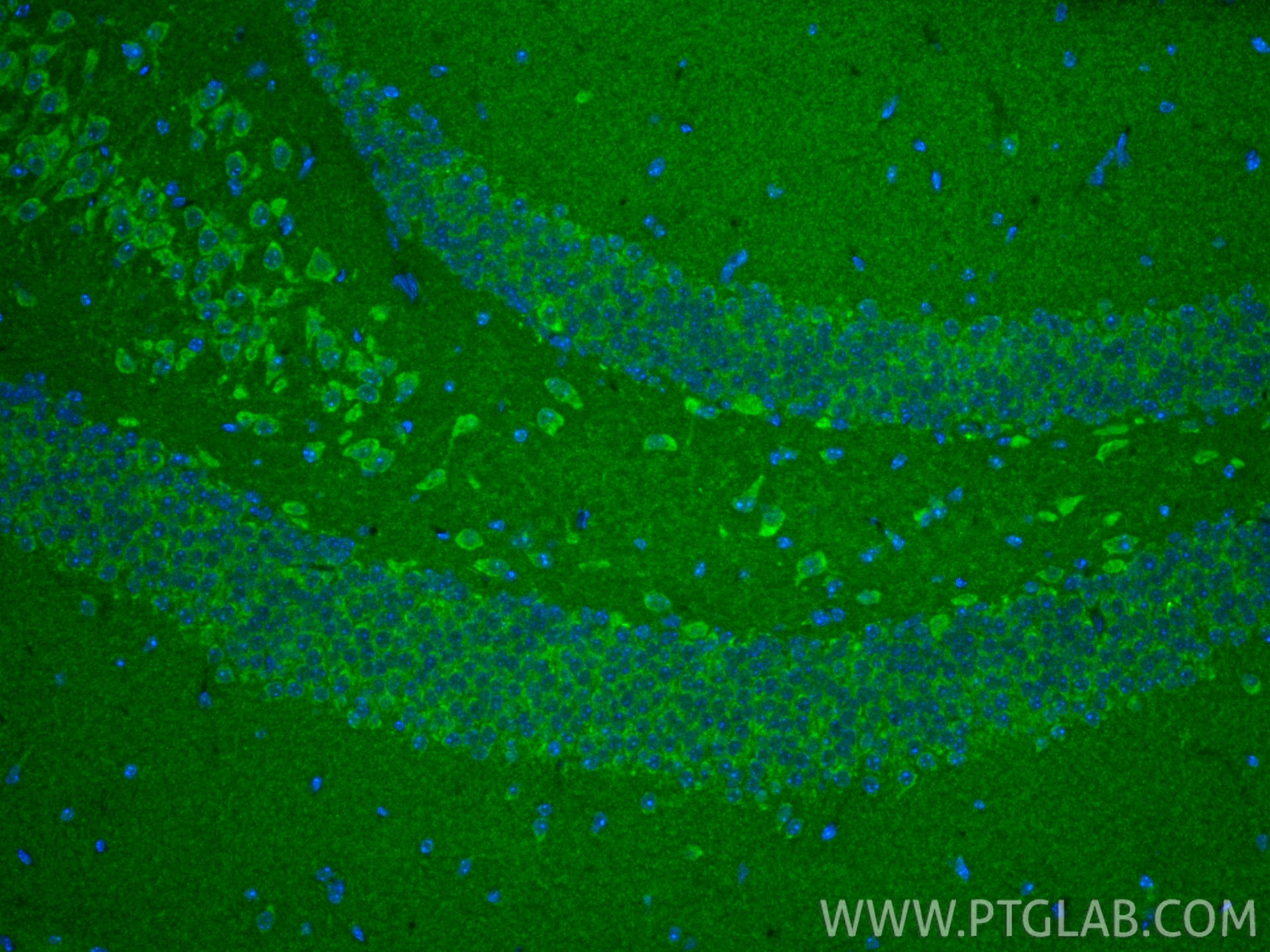 IF Staining of mouse brain using 14927-1-AP Immunofluorescence (IF) / fluorescent staining of mouse brain tissue using TIM22 Polyclonal antibody (14927-1-AP)