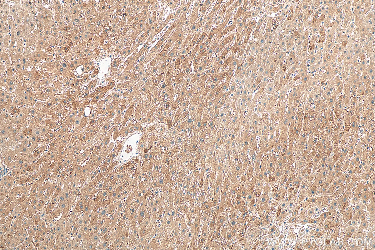 Immunohistochemistry (IHC) staining of human liver tissue using TIM22 Polyclonal antibody (14927-1-AP)