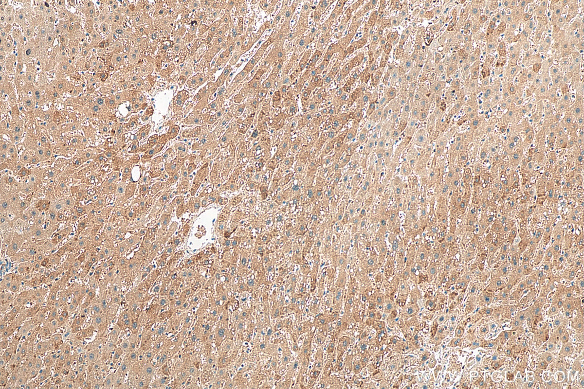 Immunohistochemistry (IHC) staining of human liver tissue using TIM22 Polyclonal antibody (14927-1-AP)
