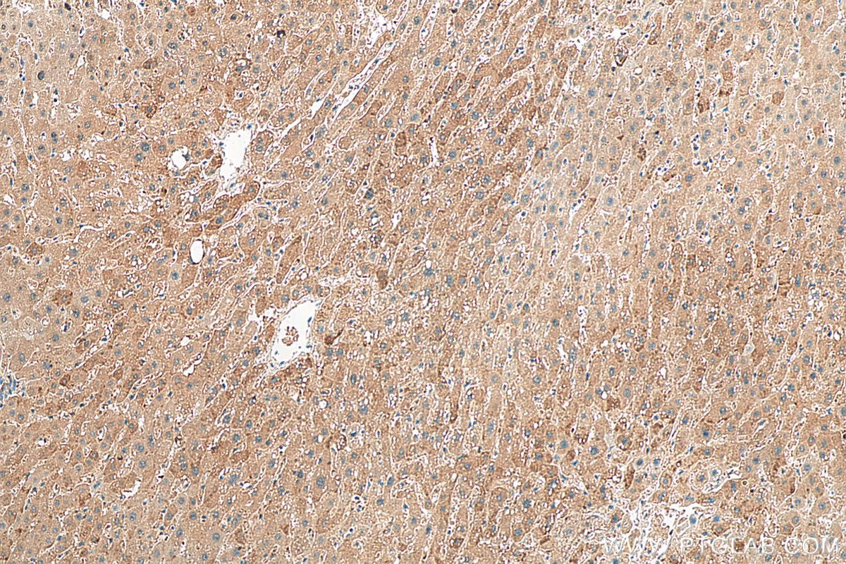 IHC staining of human liver using 14927-1-AP