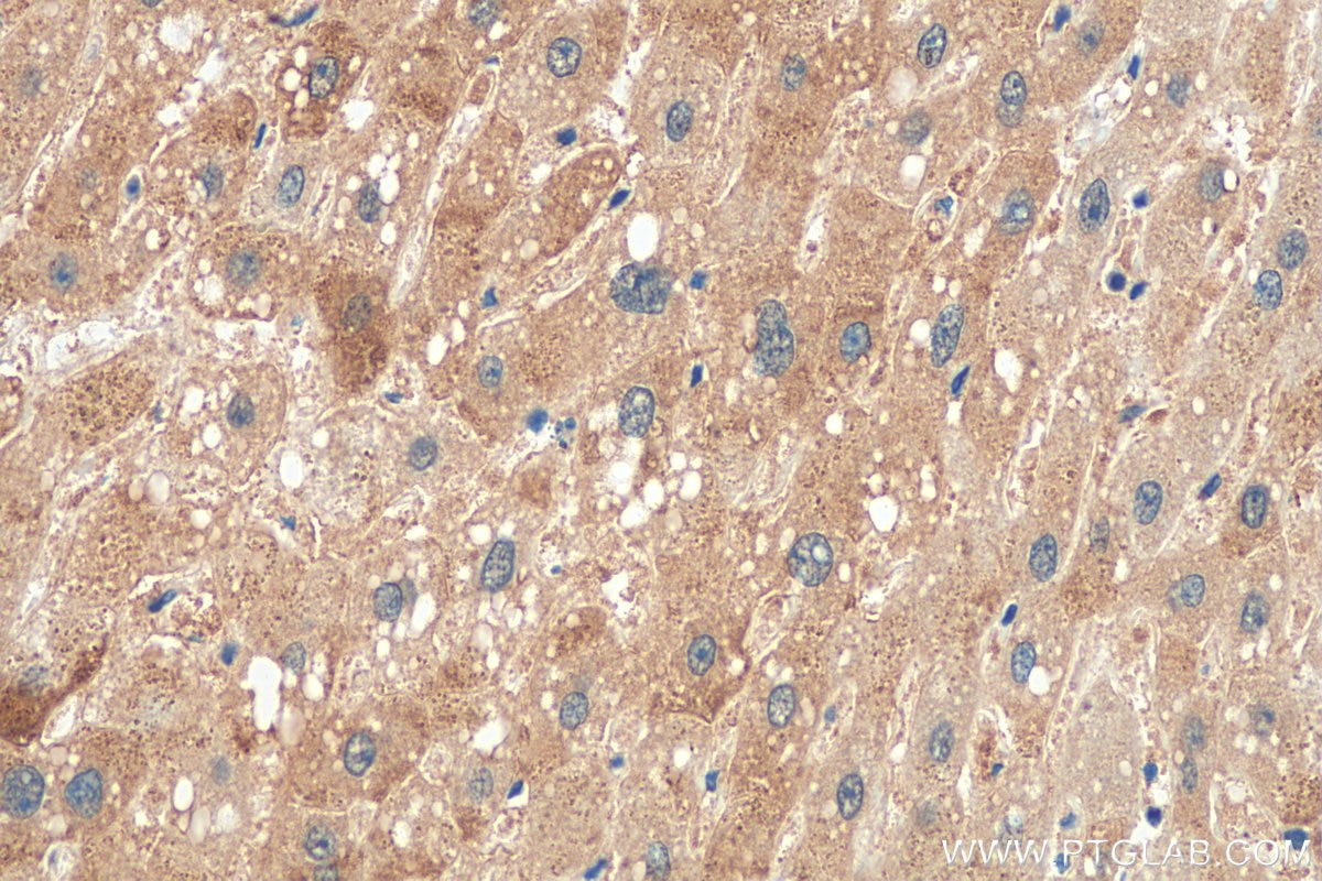Immunohistochemistry (IHC) staining of human liver tissue using TIM22 Polyclonal antibody (14927-1-AP)