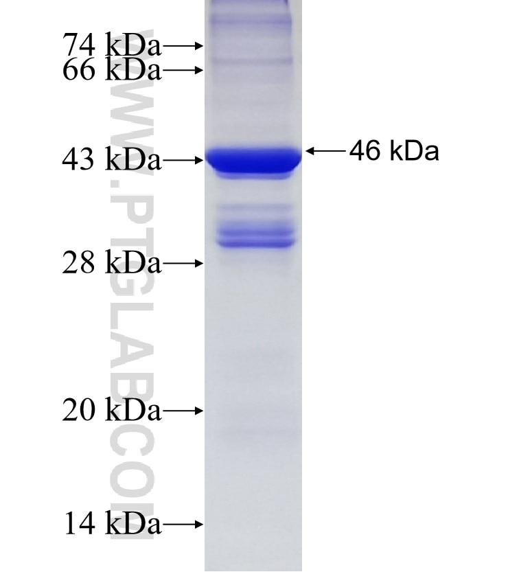 TIMM22 fusion protein Ag6689 SDS-PAGE