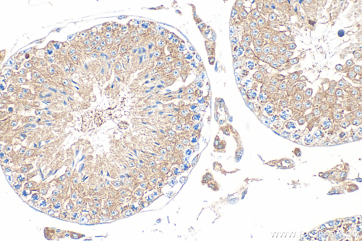 Immunohistochemistry (IHC) staining of mouse testis tissue using TIM23 Polyclonal antibody (11123-1-AP)