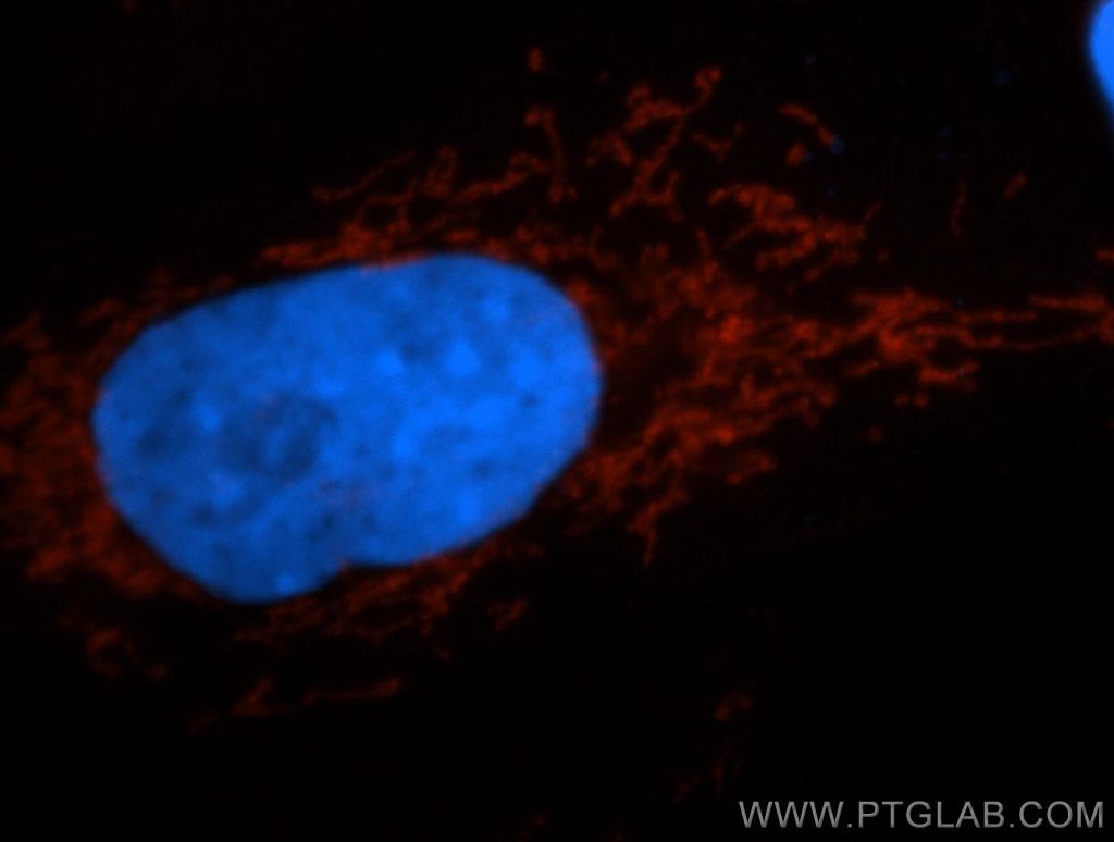 Immunofluorescence (IF) / fluorescent staining of A549 cells using TIMM44 Polyclonal antibody (13859-1-AP)