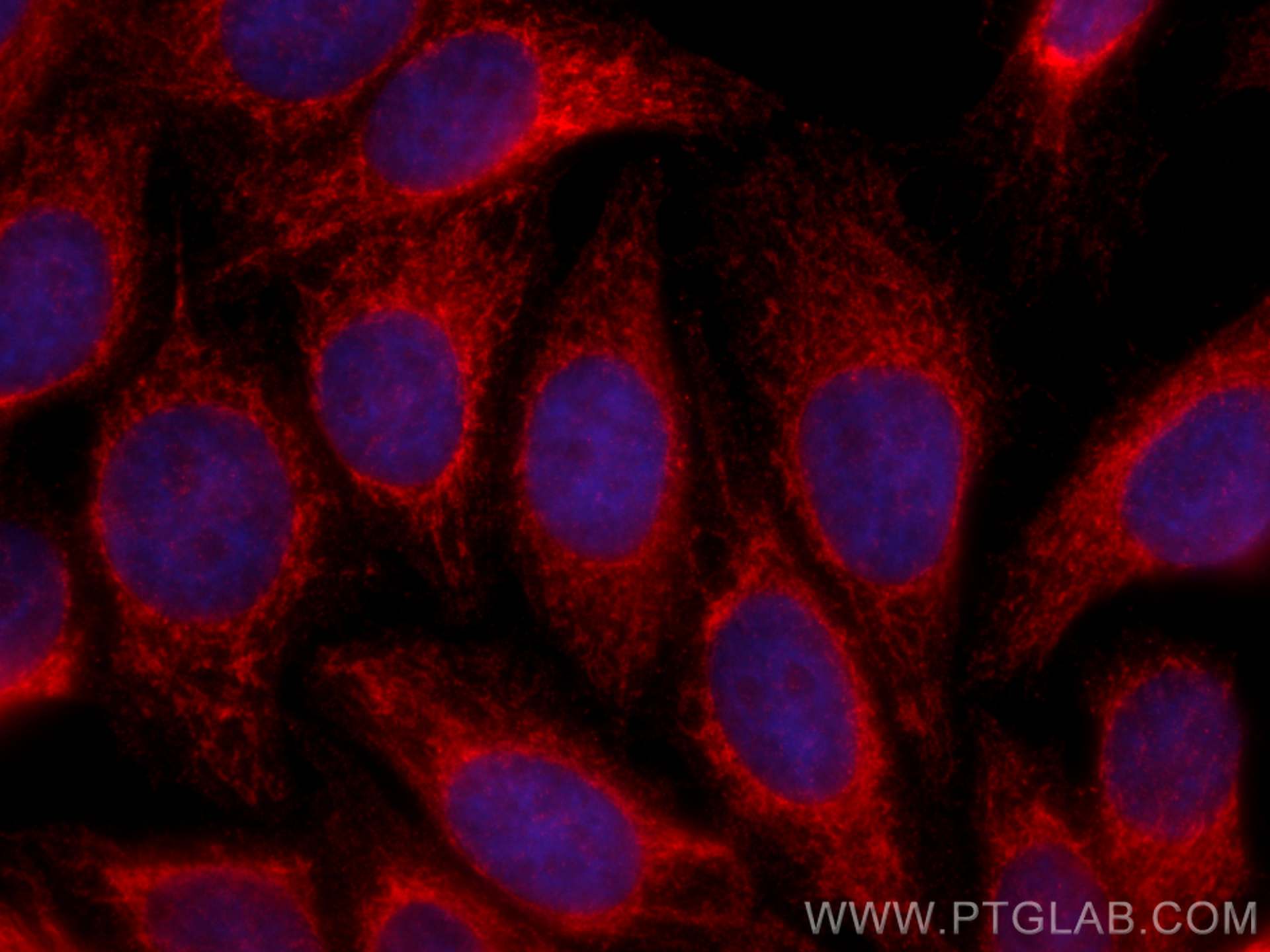 Immunofluorescence (IF) / fluorescent staining of HepG2 cells using TIMM44 Monoclonal antibody (66149-1-Ig)