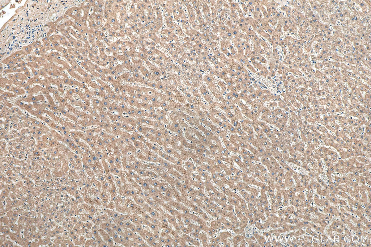 Immunohistochemistry (IHC) staining of human liver tissue using TIMM44 Monoclonal antibody (66149-1-Ig)