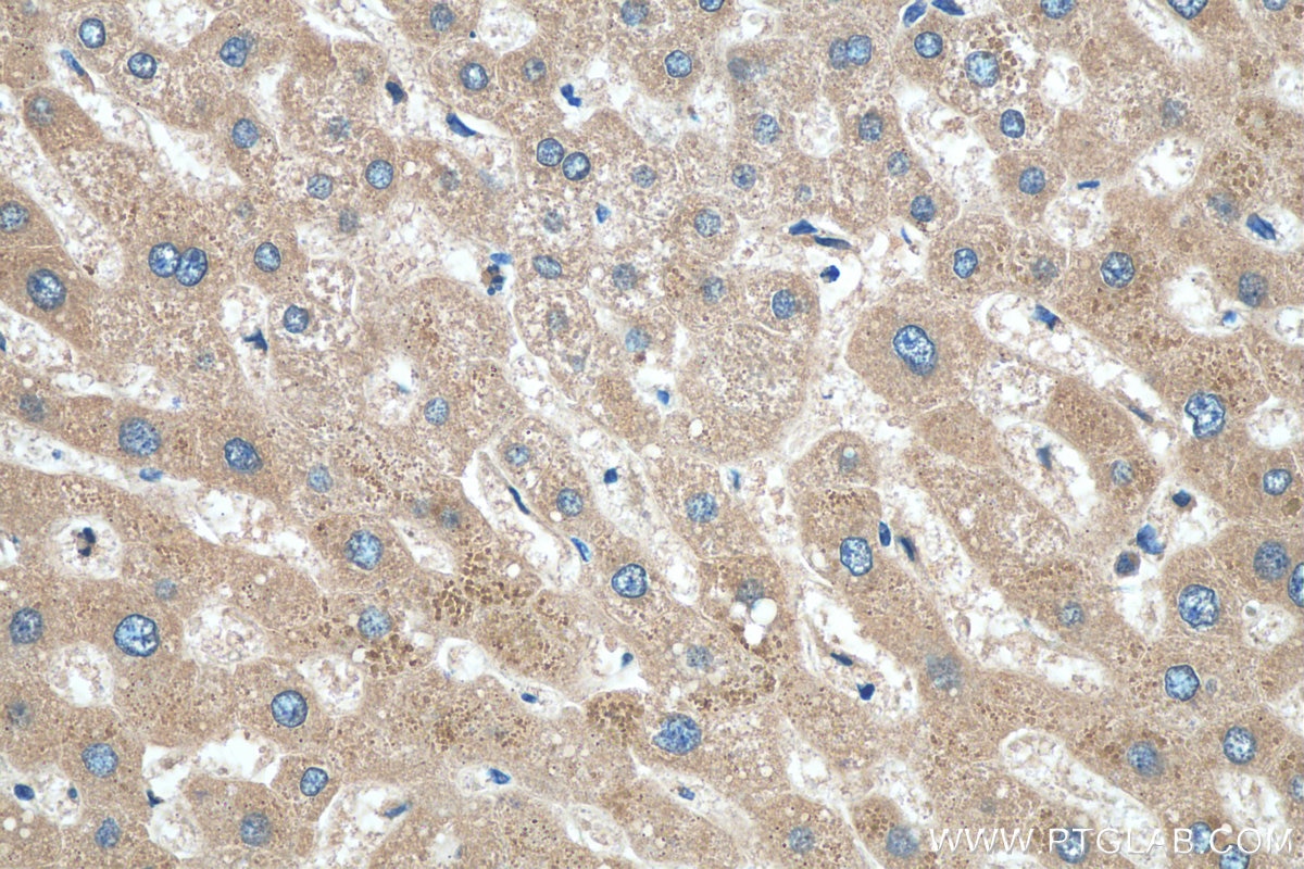 Immunohistochemistry (IHC) staining of human liver tissue using TIMM44 Monoclonal antibody (66149-1-Ig)