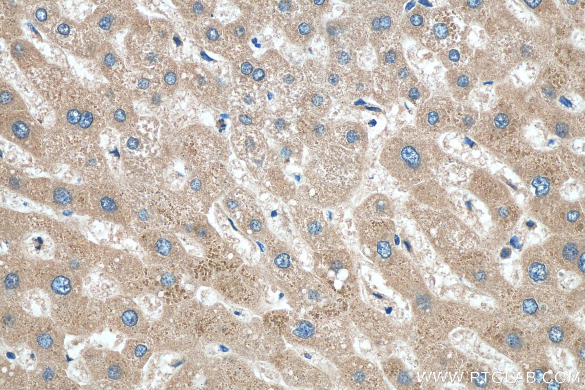 IHC staining of human liver using 66149-1-Ig