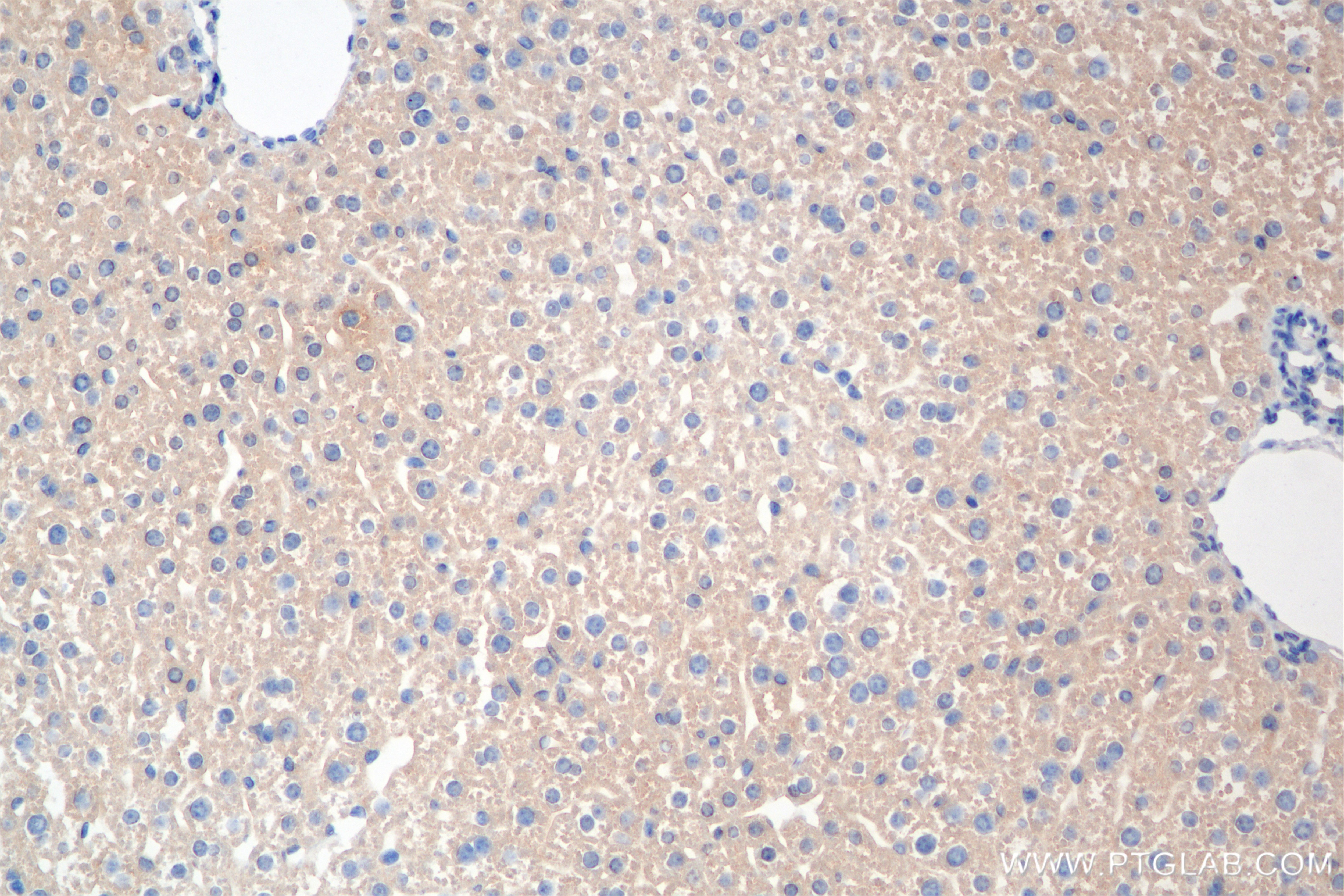 Immunohistochemistry (IHC) staining of mouse liver tissue using TIMM44 Recombinant antibody (85134-5-RR)