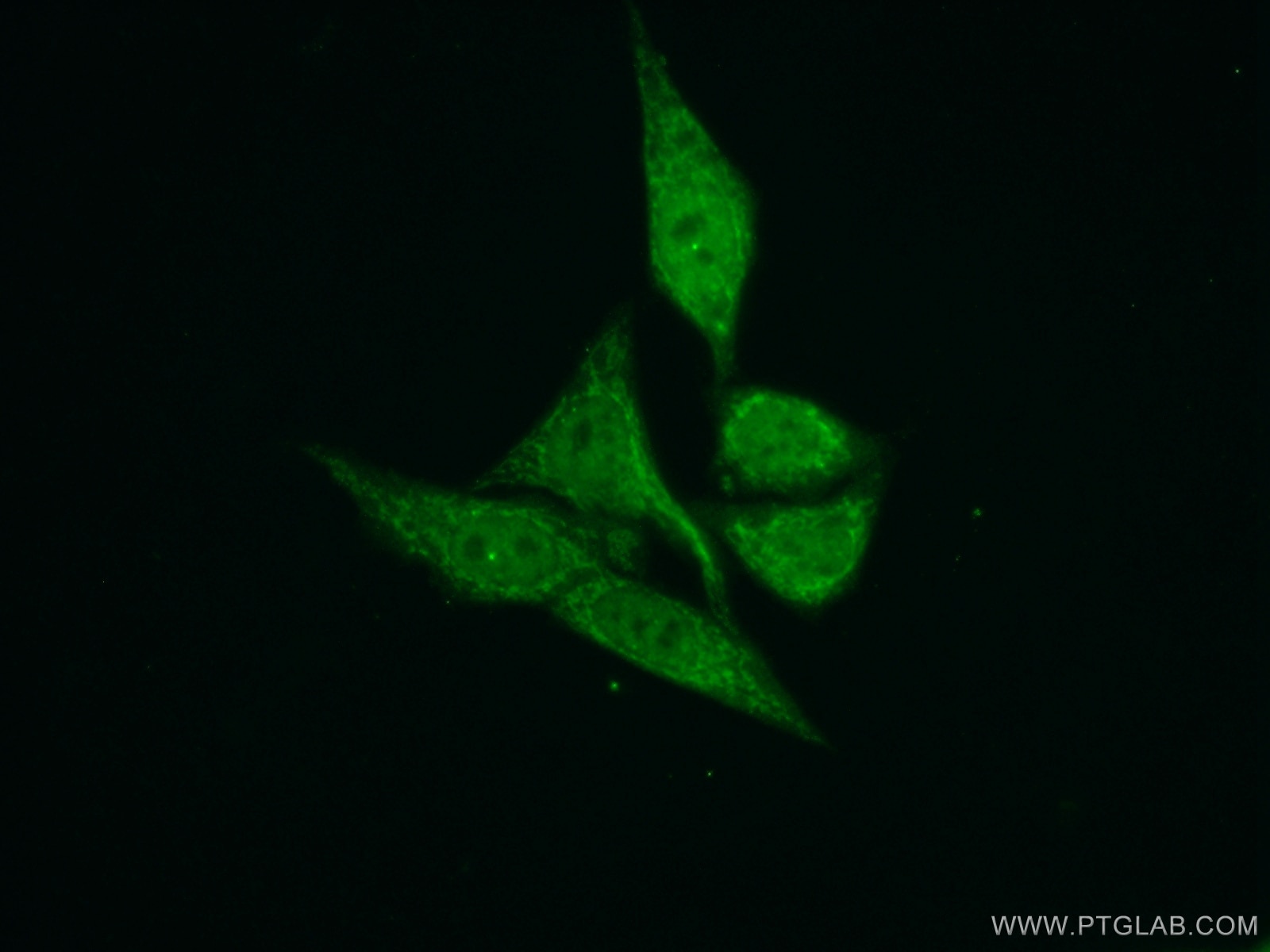 Immunofluorescence (IF) / fluorescent staining of HepG2 cells using TIMM50 Polyclonal antibody (22229-1-AP)