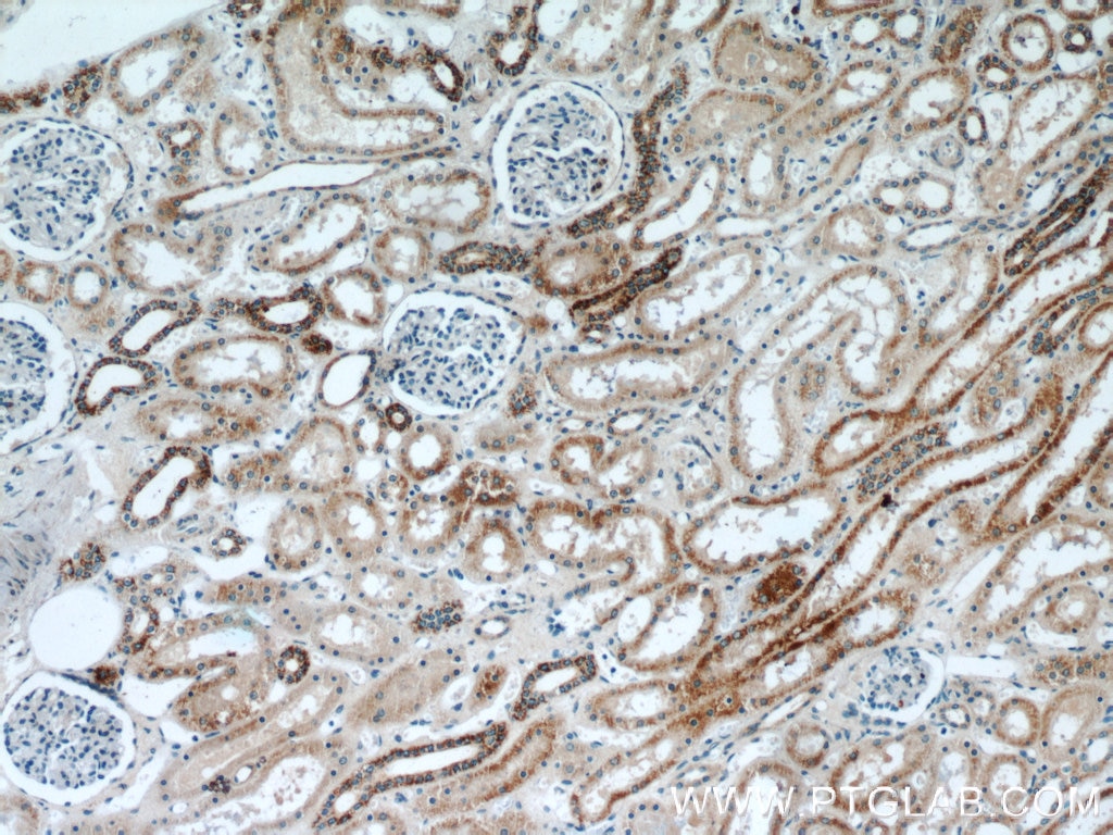 Immunohistochemistry (IHC) staining of human kidney tissue using TIMM50 Polyclonal antibody (22229-1-AP)