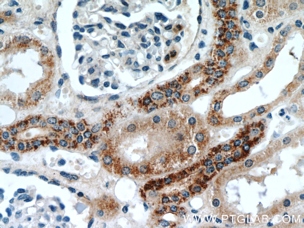 Immunohistochemistry (IHC) staining of human kidney tissue using TIMM50 Polyclonal antibody (22229-1-AP)