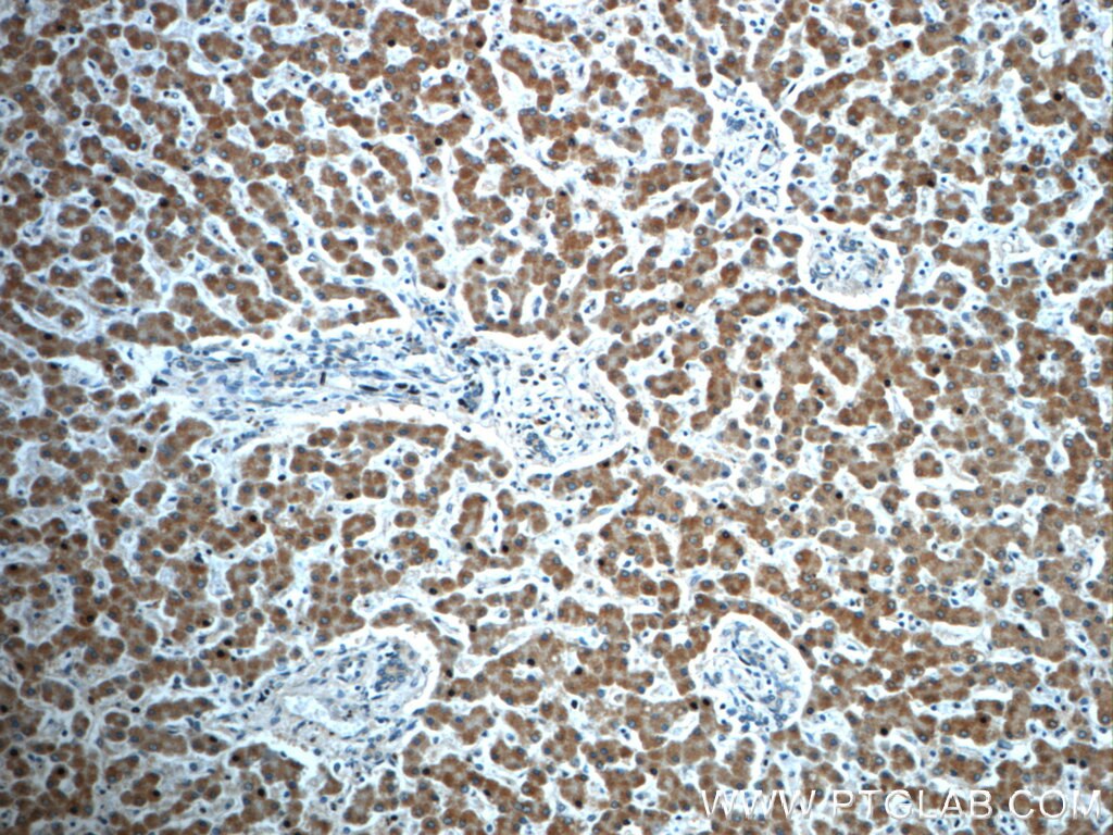 Immunohistochemistry (IHC) staining of human liver tissue using TIMM50 Polyclonal antibody (22229-1-AP)