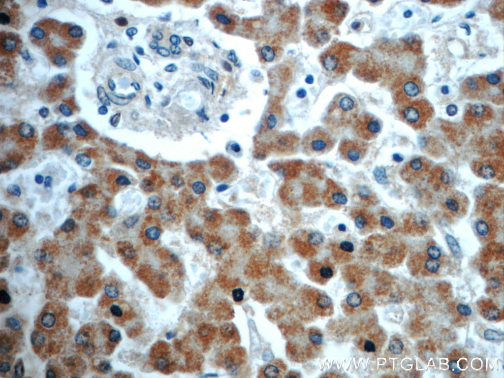 Immunohistochemistry (IHC) staining of human liver tissue using TIMM50 Polyclonal antibody (22229-1-AP)