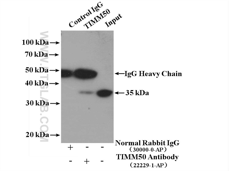 Immunoprecipitation (IP) experiment of HeLa cells using TIMM50 Polyclonal antibody (22229-1-AP)