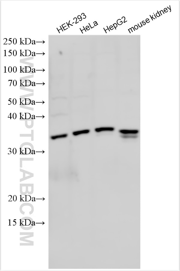 Western Blot (WB) analysis of various lysates using TIMM50 Polyclonal antibody (22229-1-AP)
