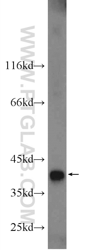 Western Blot (WB) analysis of HeLa cells using TIMM50 Polyclonal antibody (22229-1-AP)