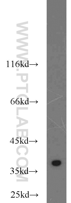 Western Blot (WB) analysis of HepG2 cells using TIMM50 Polyclonal antibody (22229-1-AP)